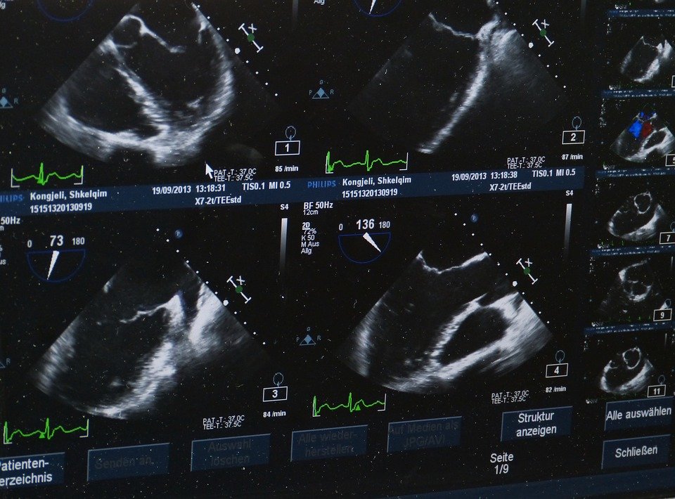 À quoi sert une échographie ?